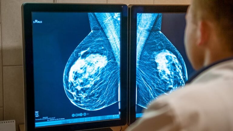 Mammogram Examination Selective Focus